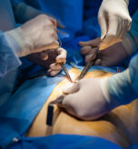 When-Gallbladder-Surgery-Is-Needed-Arizona-Premier-Surgery