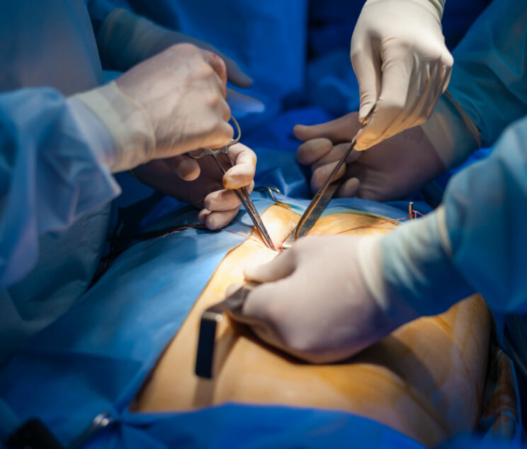 When-Gallbladder-Surgery-Is-Needed-Arizona-Premier-Surgery